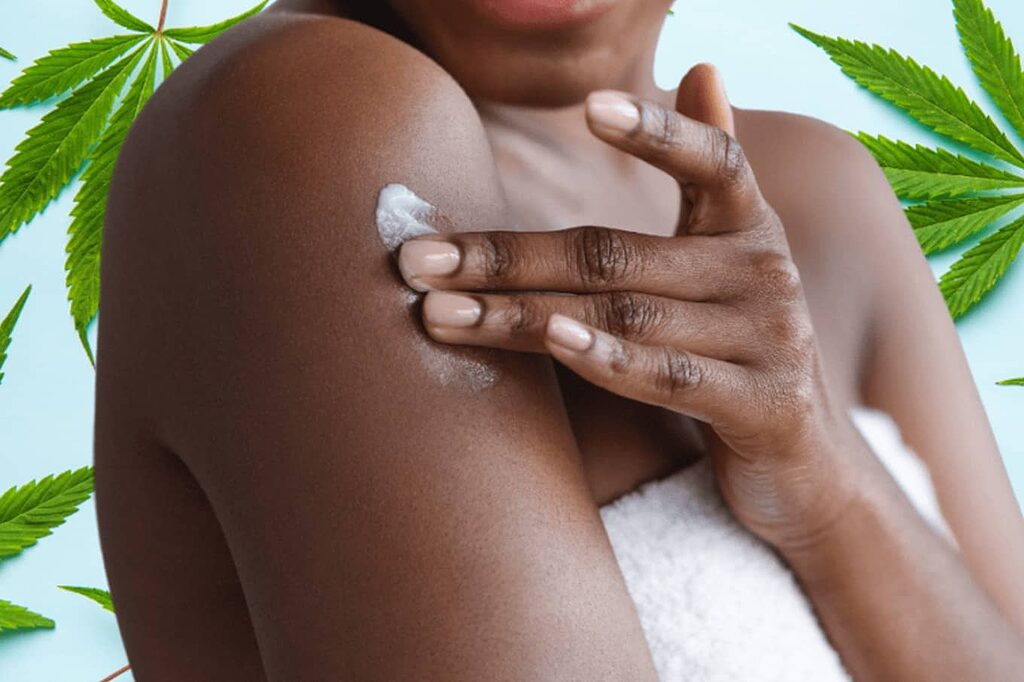 Topical Application of CBD Cream for Local Relief