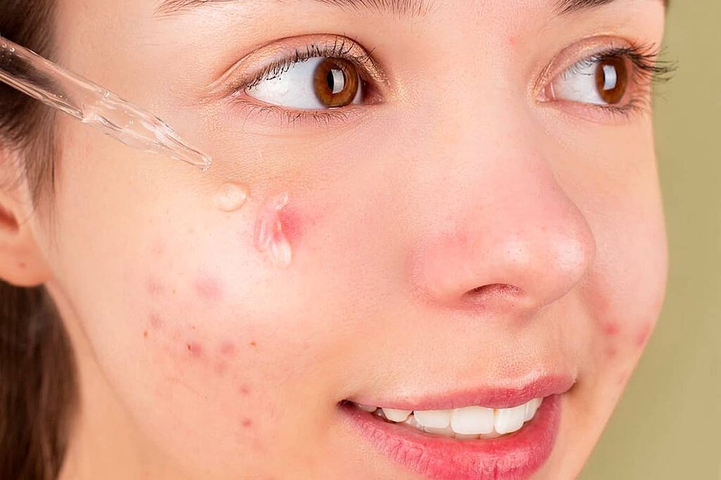 Sensitive skin? Tread carefully. Avoid harsh actives like glycolic acid and retinol. Embrace the gentle embrace of hyaluronic acid, aloe vera, and chamomile for ageless, irritation-free radiance.